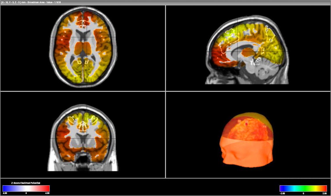 Brain Map