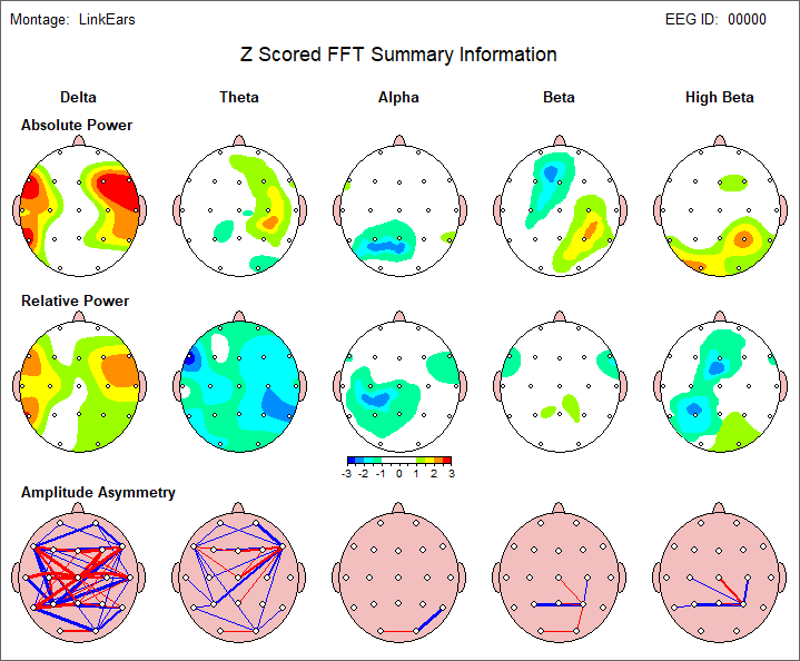 Brain Map